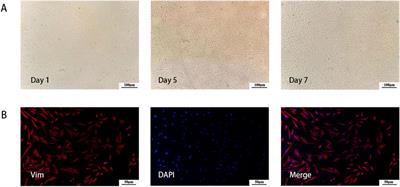 Effects of platelet-rich fibrin on human endometrial stromal cells behavior in comparison to platelet-rich plasma